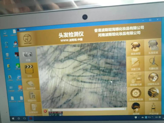 波斯坦养发采用进口的毛发检测仪